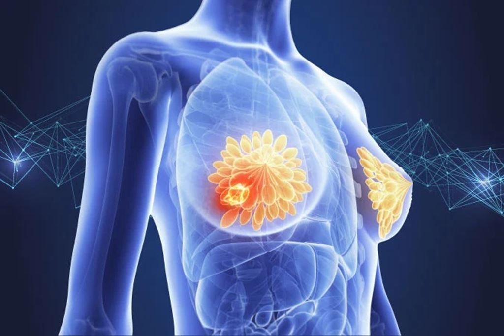 National Breast Cancer Awareness Month